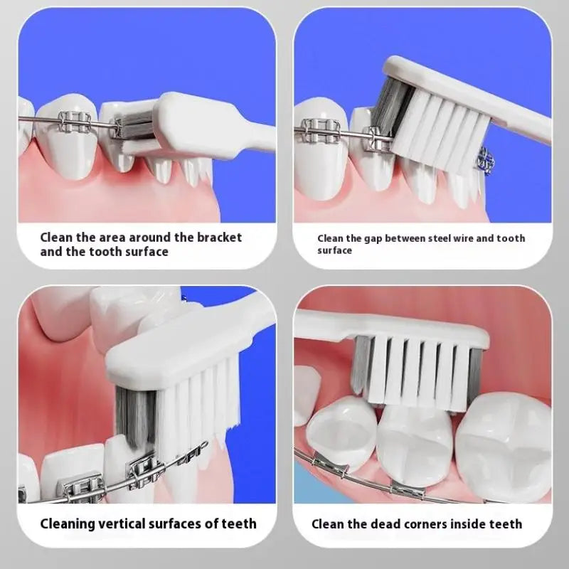 CompactSmile Ortho™